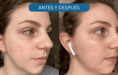 4 Skinceuticals C E Ferulic Serum 30 ml - ¡OFERTA!